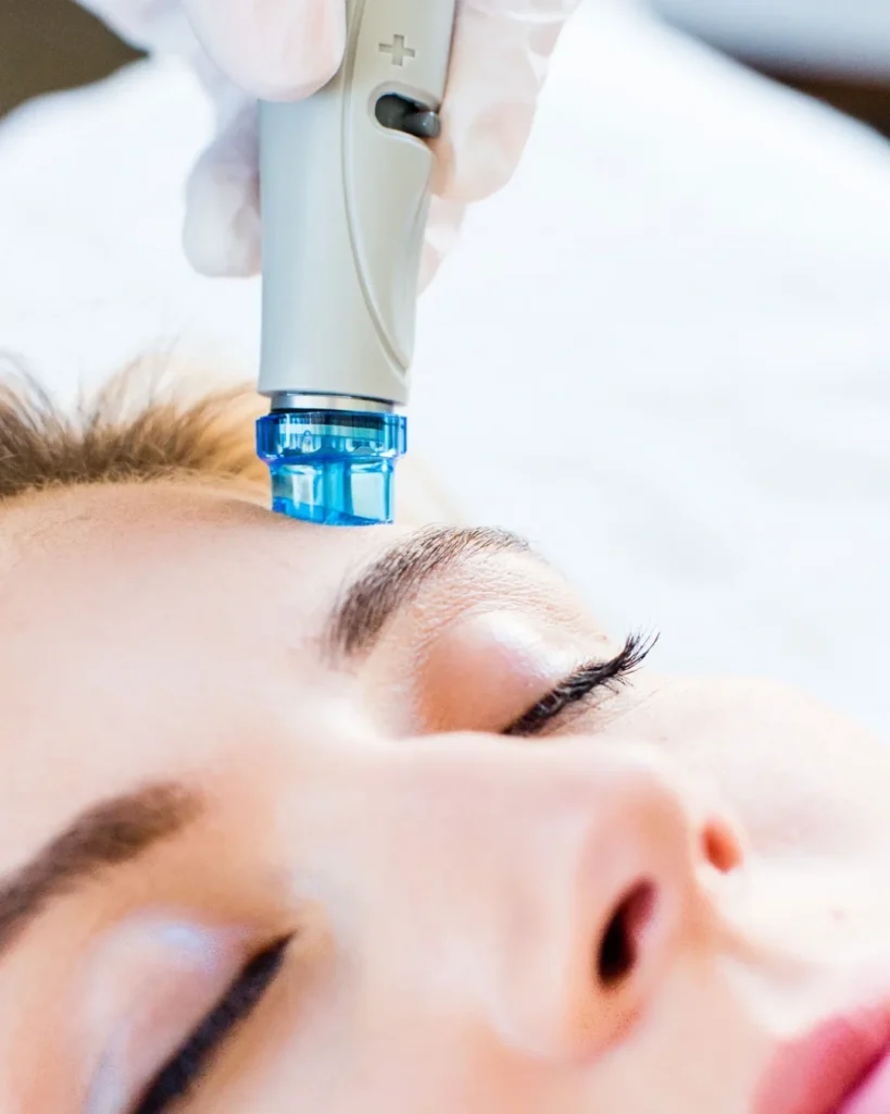 Portfolio 1 Skinvive Hydrafacial at B Medical Spa in San Diego, CA
