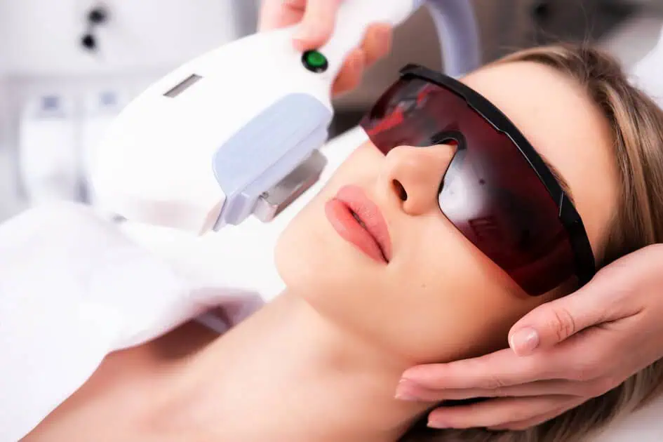 IPL Photofacial by B Medical Spa and Wellness Center in San Diego, CA