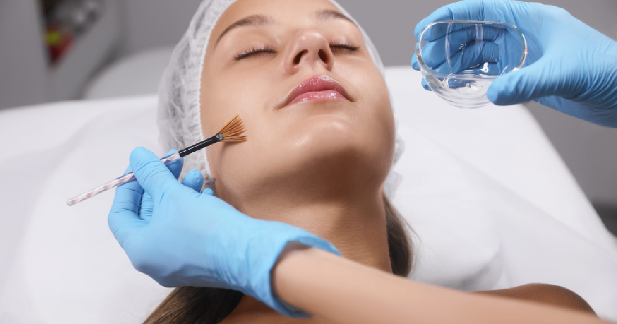 Woman receiving a VI Peel as a professional applies solution with a brush in a clinical setting in San Diego, CA