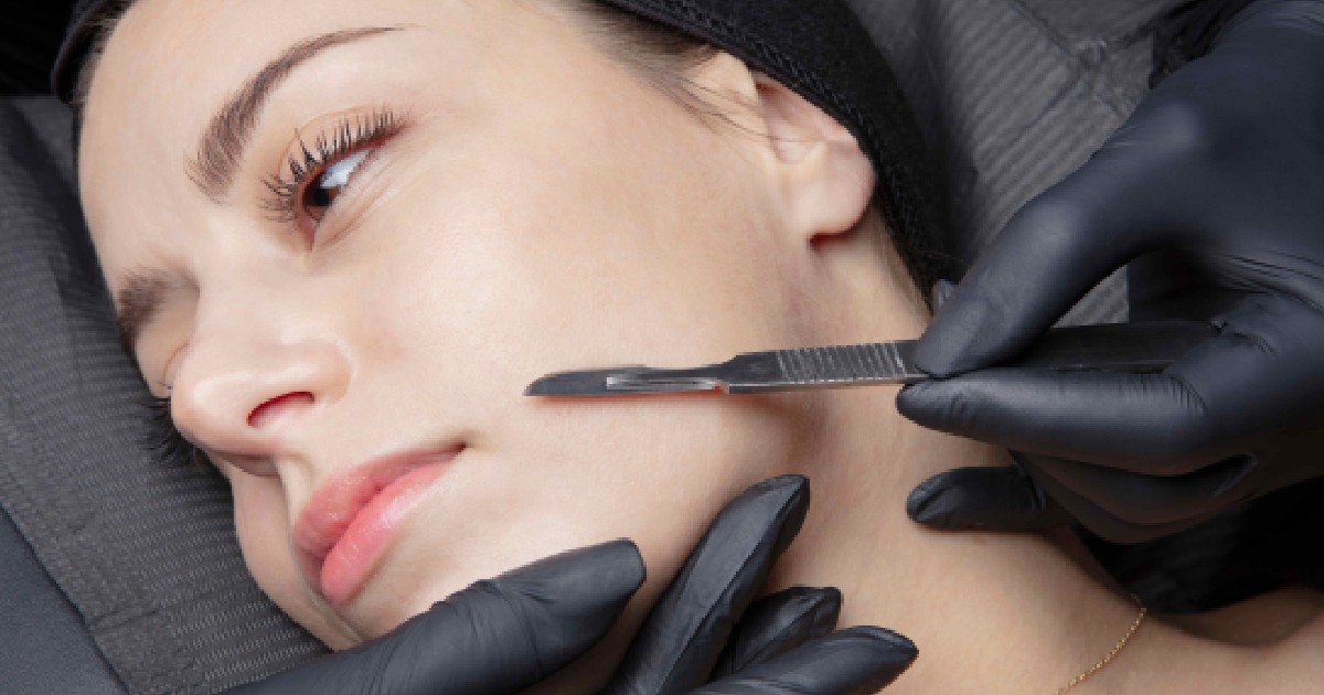 close-up of a woman receiving professional dermaplaning in San Diego, with a specialist gently exfoliating the skin using a scalpel tool.