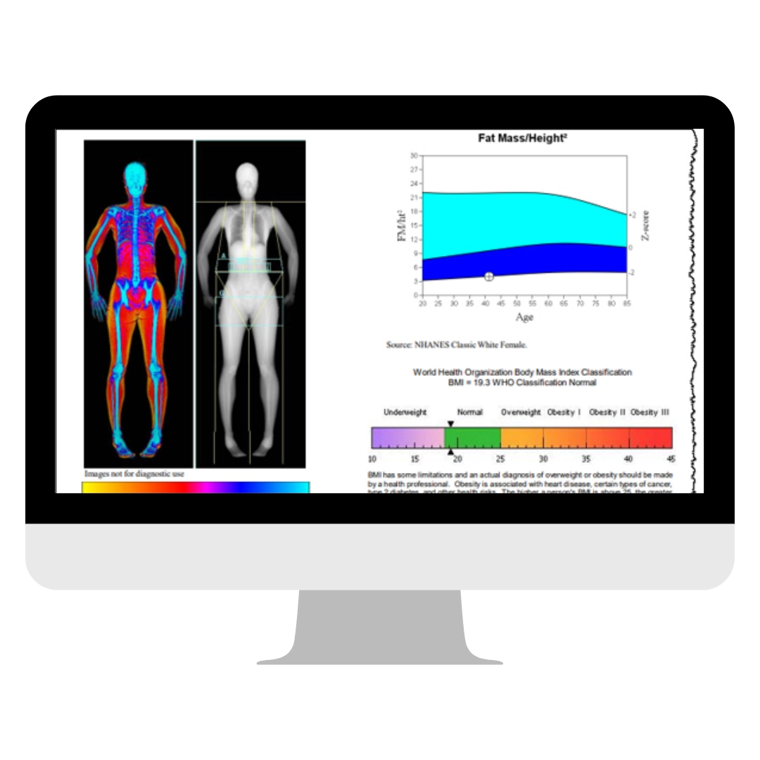 Dexa Scans in San Diego, CA | B Medical Spa