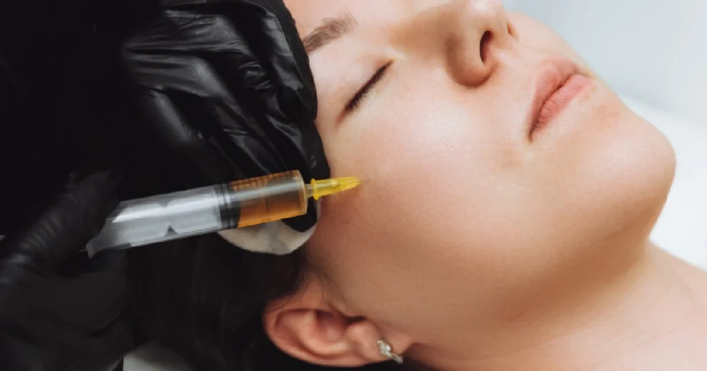 Women receiving Dermal Fillers in San Diego, CA (1)
