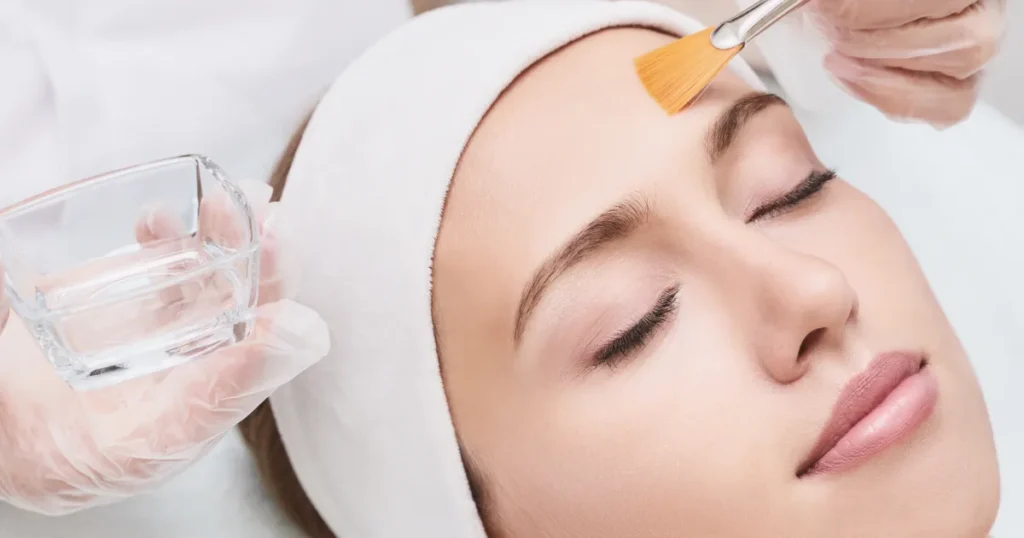 VI Peel Benefits for Acne & Aging Skin: A Complete Guide to Skin Renewal 2 A women receiving VI Peel in San Diego, CA